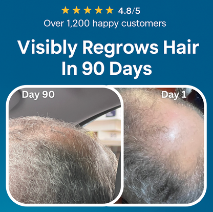 Peptonix Micro-Infusion System For Hair Regrowth